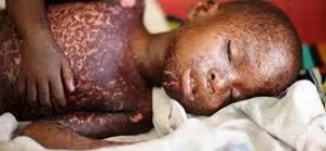 IMG_202506173_085001893