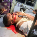 Sport Travailliste : Président du Cercle territorial du sport Travailliste et Amateur de Beni/OIcha ‘’CETSTRABE’’, Patcheko a connu un accident mortel le dimanche 16 août